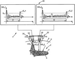 MEDICAL SYSTEM AND METHOD FOR LOCATING AN ENTRY POINT OF A SURGICAL INSTRUMENT IN AN ANATOMICAL STRUCTURE AND FOR IDENTIFYING A TRAJECTORY OF THE SURGICAL INSTRUMENT IN THE ANATOMICAL STRUCTURE, AND ASSEMBLY COMPRISING SUCH A MEDICAL SYSTEM AND A SURGICAL INSTRUMENT