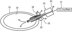 Endoscopic vessel harvesting devices with conditioning of insufflation gas