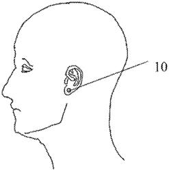 Wearable Apparatus For Continuous Monitoring Of Physiological Parameters