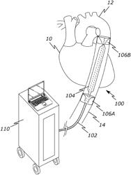 CIRCULATORY SUPPORT DEVICES AND METHODS