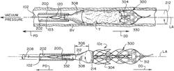 Catheter funnel extension