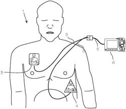 ECG and defibrillator electrode detection and tracking system and method