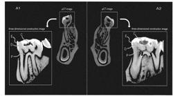 DENTAL CARE COMPOSITION AND METHOD OF PROMOTING CALCIFICATION IN LIVING BODY TISSUE