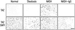 IHH AS A BIOMARKER AND THERAPEUTIC TARGET FOR NONALCOHOLIC STEATOHEPATITIS (NASH)