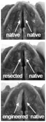 Bioengineered vocal fold mucosa for functional voice restoration