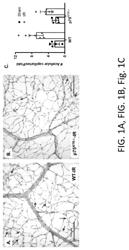 COMPOSITIONS AND METHODS USED FOR RETINAL ISCHEMIA OR DIABETES