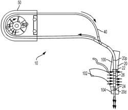 System and method for treatment of pulmonary edema