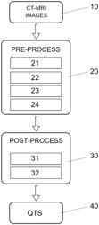 Method for obtaining an image biomarker that quantifies the quality of the trabecular structure of bones