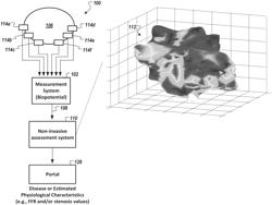 Method and system to assess disease using phase space tomography and machine learning