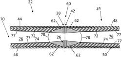 Wind turbine blade