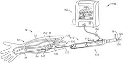 ATHERECTOMY DEVICES AND METHODS