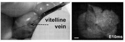 IN UTERO CRISPR-MEDIATED THERAPEUTIC EDITING OF GENES