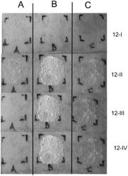 TOPICAL FORMULATION CONTAINING DISPERSED PREGABALIN