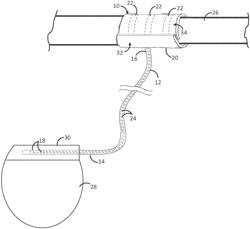 SELF-EXPANDING NERVE CUFF ELECTRODE