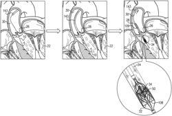 IMPELLER FRAME