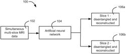 Multi-slice MRI data processing using deep learning techniques