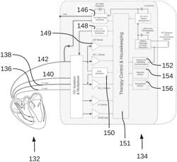 COMBINED IMPLANTABLE PULSE GENERATOR DEVICE