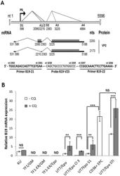 NOVEL HUMAN ERYTHROID PROGENITOR CELL LINE HIGHLY PERMISSIVE TO B19 INFECTION AND USES THEREOF