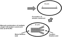 Engineered tendon graft for rotator cuff repair