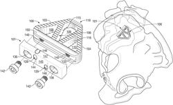 Implants and implantation techniques for sacroiliac joint fusion