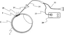 Ocular injector and methods for accessing suprachoroidal space of the eye