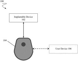 User centered system for recharging implanted neurostimulator