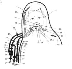 Assistive Respiration Apparatus