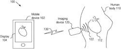 Imaging devices having piezoelectric transceivers with harmonic characteristics