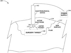 STRUCTURED ELECTRODE FOR VAPOR POCKET IGNITION