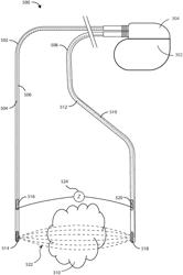 ELECTRICAL STIMULATION DEVICES FOR CANCER TREATMENT