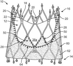 Stented prosthetic heart valve having a paravalvular sealing wrap