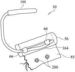 Epicardial valve repair system