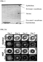 COMPOSITIONS AND METHODS FOR PREVENTION AND TREATMENT OF CORNEAL HAZE AND SCARRING