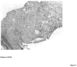 Cancer therapy with an oncolytic virus combined with a checkpoint inhibitor