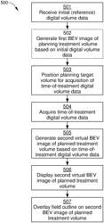 Virtual beam's-eye view imaging in radiation therapy for patient setup