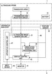 ULTRASOUND DIAGNOSTIC APPARATUS AND CONTROL METHOD OF ULTRASOUND DIAGNOSTIC APPARATUS