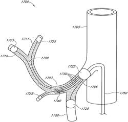 NEUROMODULATION FOR METABOLIC CONDITIONS OR SYNDROMES