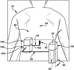 AMBULATORY FLUID DRAINAGE AND COLLECTION DEVICE