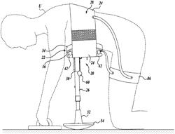 BODY SUPPORT DEVICE HAVING LOCKING LEG