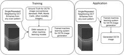 Method and apparatus for optical coherence tomography angiography