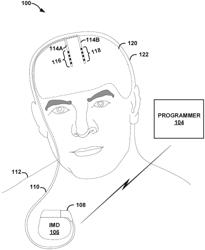 DETERMINING RELATIVE PHASE RELATIONSHIPS FOR DELIVERY OF ELECTRICAL STIMULATION THERAPY