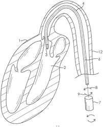 FLUID PUMP WITH A ROTOR