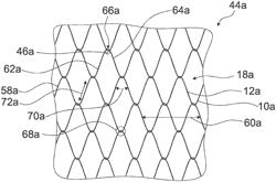 Wire netting system