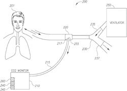 SIDE-STREAM VOLUMETRIC CAPNOGRAPHY