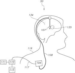 ELECTRODE ARRAY FOR SPATIALLY RANDOM ELECTRICAL STIMULATION