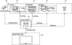 SYSTEMS AND METHODS FOR AUXILIARY DISPLAY OF HEMODYNAMIC SIGNALS OR INDICATORS