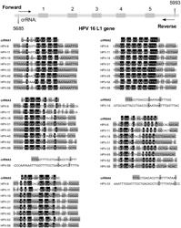 MULTIPLEXED NUCLEIC ACID DETECTION KIT FOR HUMAN PAPILLOMAVIRUS (HPV) TYPING, AND DETECTION METHOD