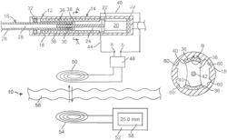 Devices and methods for non-invasive implant length sensing