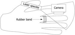 HEMODILUTION DETECTOR