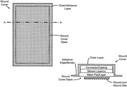 Wound Cover to Detect and Monitor a Wound Status, and Method of Using Same